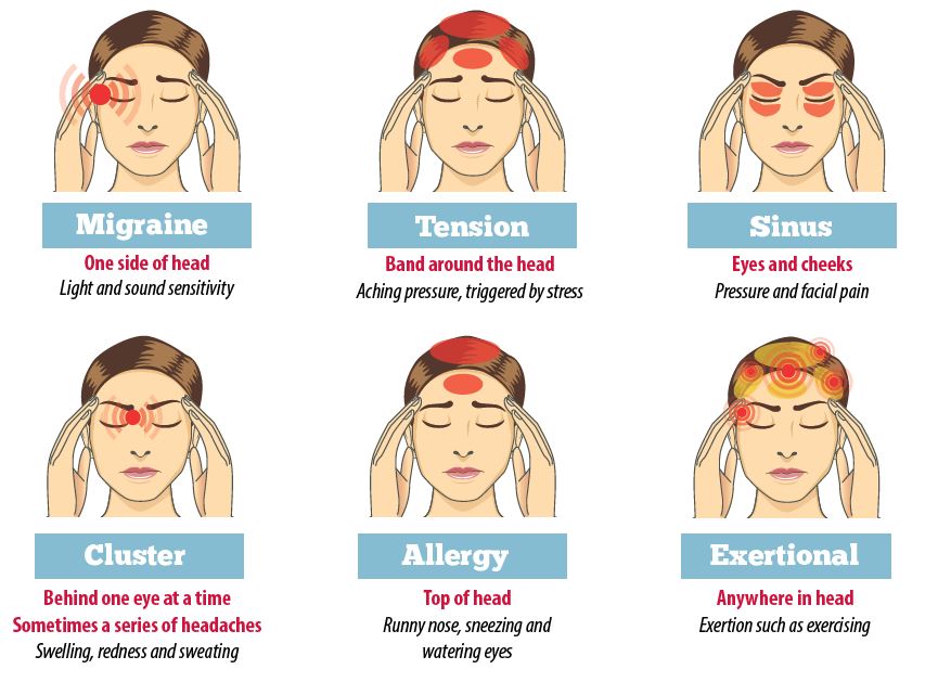 why-do-i-get-headaches-frequently-in-2022-jaipur-neuro-clinic